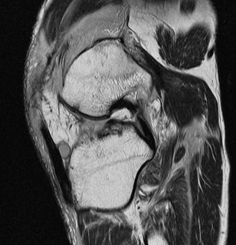 Figure 6 for case arcuate sign